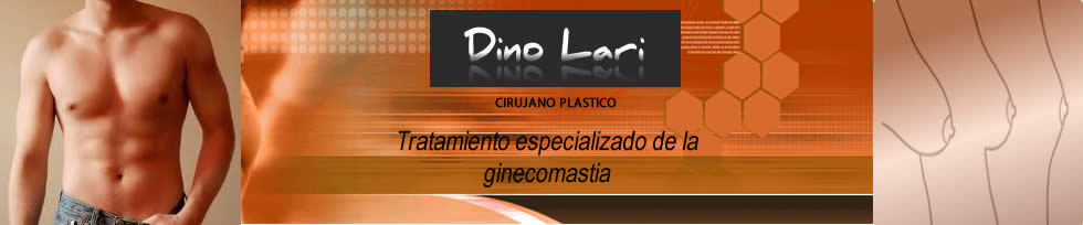 El Portal de la Ginecomastia